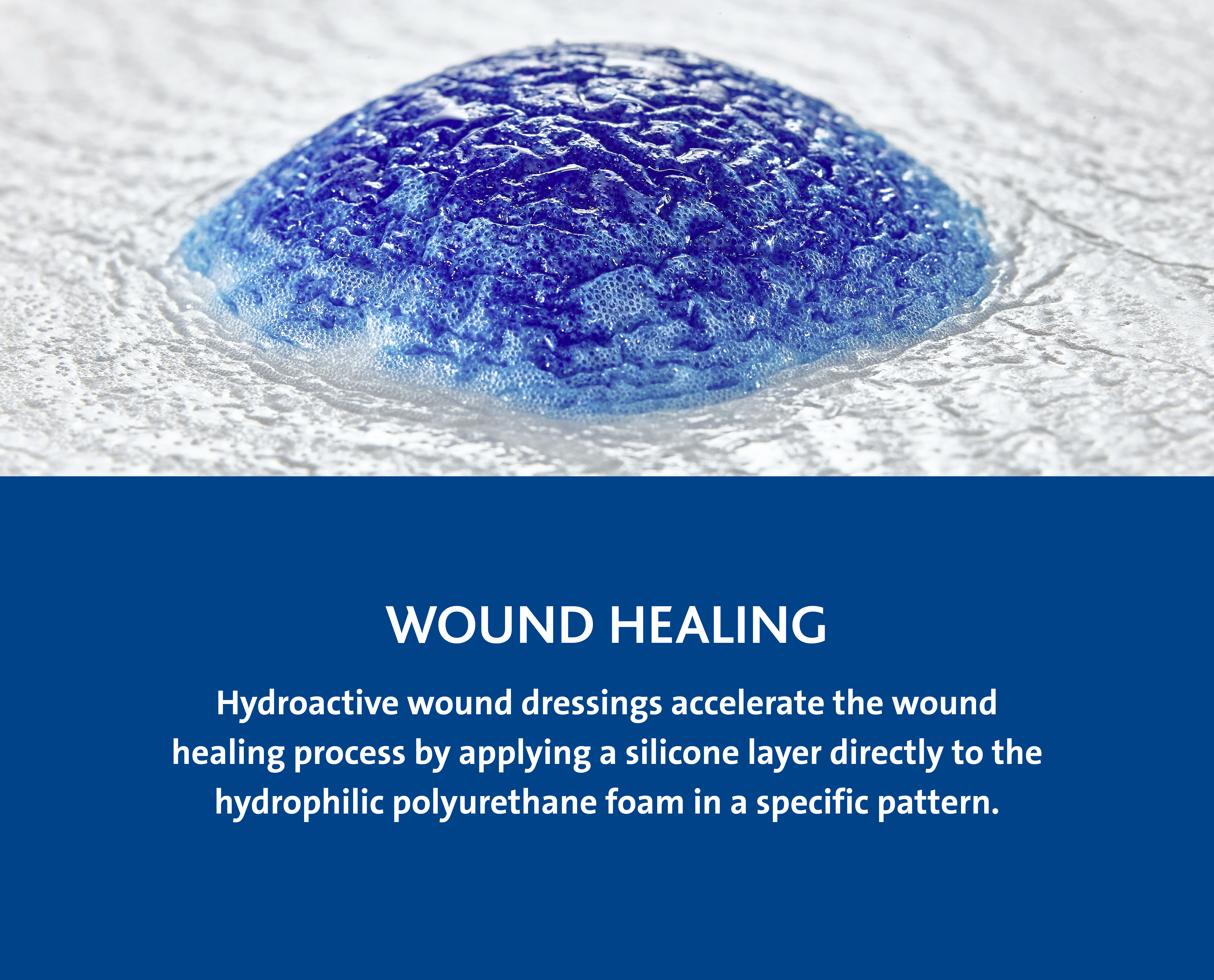 innovations milestones woundhealing